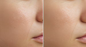 skin improvement and daily habits through quality sleep and stress relief