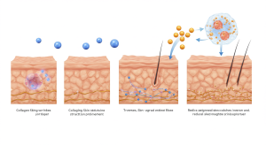 skin improvement and daily habits with exercise and circulation boost