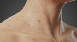 skin improvement and daily habits protected by sunscreen and cleansing