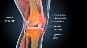 knee health and daily habits improved with balanced nutrition and hydration