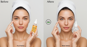 woman applying sunscreen for skin pigmentation treatment